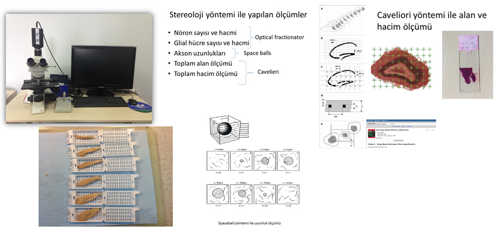 Dokuz Eylül Üniversitesi Türkiyenin Stereolojik İnceleme Yapılan İlk Patoloji Bölümü