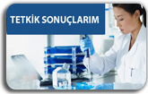 Tetkik sonu&ccedil;larım
