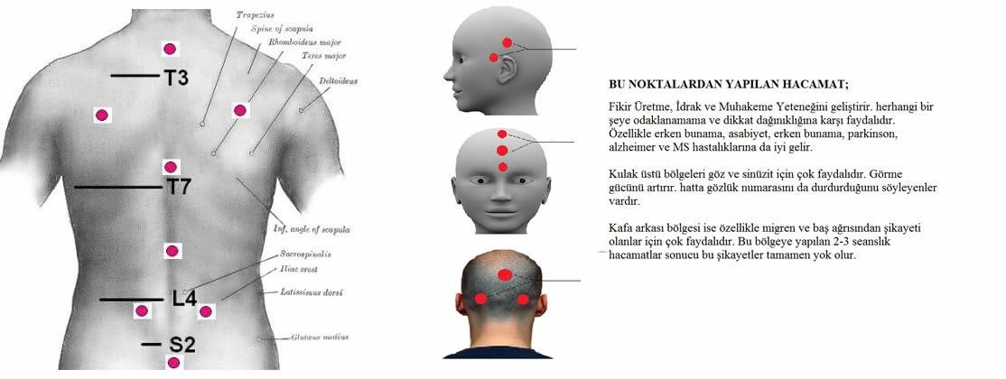 kupa2